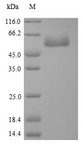 FAK / Focal Adhesion Kinase Protein - (Tris-Glycine gel) Discontinuous SDS-PAGE (reduced) with 5% enrichment gel and 15% separation gel.