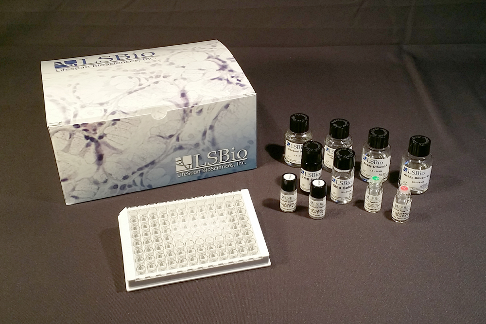 Ferritin ELISA Kit