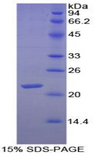 FN1 / Fibronectin Protein - Recombinant Fibronectin By SDS-PAGE