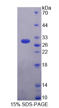GSTA3 Protein - Recombinant Glutathione S Transferase Alpha 3 By SDS-PAGE