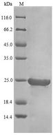 IFN Beta / Interferon Beta Protein - (Tris-Glycine gel) Discontinuous SDS-PAGE (reduced) with 5% enrichment gel and 15% separation gel.