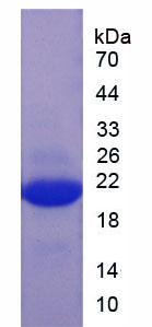 IL-1B / IL-1 Beta Protein - Recombinant Interleukin 1 Beta (IL1b) by SDS-PAGE