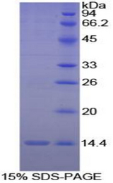 IL8 / Interleukin 8 Protein - Recombinant Interleukin 8 By SDS-PAGE