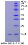 INHBB / Inhibin Beta B Protein - Recombinant Inhibin Beta B By SDS-PAGE