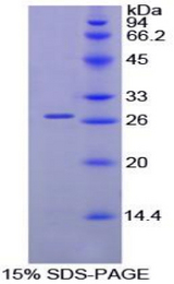 KIAA0152 / MLEC Protein - Recombinant Malectin By SDS-PAGE