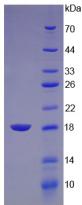LYZ / Lysozyme Protein - Recombinant Lysozyme By SDS-PAGE