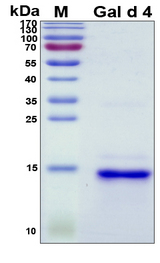 LYZ / Lysozyme Protein - SDS-PAGE under reducing conditions and visualized by Coomassie blue staining