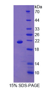 MB / Myoglobin Protein - Recombinant Myoglobin By SDS-PAGE