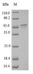 MYLK Protein - (Tris-Glycine gel) Discontinuous SDS-PAGE (reduced) with 5% enrichment gel and 15% separation gel.