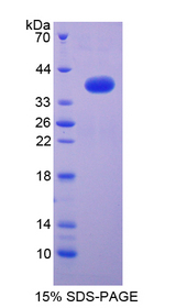 NFKB2 Protein - Recombinant  Nuclear Factor Kappa B2 By SDS-PAGE