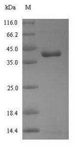 RHOT1 Protein - (Tris-Glycine gel) Discontinuous SDS-PAGE (reduced) with 5% enrichment gel and 15% separation gel.