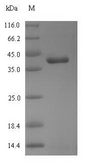 RHOT1 Protein - (Tris-Glycine gel) Discontinuous SDS-PAGE (reduced) with 5% enrichment gel and 15% separation gel.