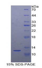 SEMA3E / Semaphorin 3E Protein - Recombinant Semaphorin 3E By SDS-PAGE
