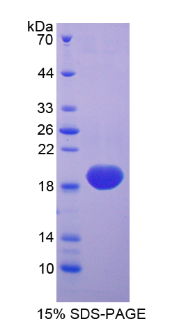 SOD1 / Cu-Zn SOD Protein - Recombinant  Superoxide Dismutase 1, Soluble By SDS-PAGE
