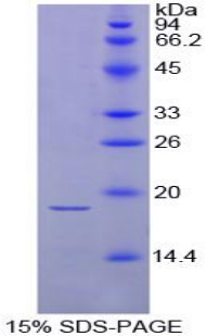 TSHB / TSH-Beta Protein - Recombinant Thyroid Stimulating Hormone Beta (TSHb) by SDS-PAGE