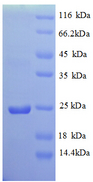 VAMP7 / SYBL1 / T1 VAMP Protein