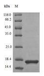 VP3 / Apoptin Protein - (Tris-Glycine gel) Discontinuous SDS-PAGE (reduced) with 5% enrichment gel and 15% separation gel.