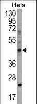 CHID1 Antibody - CHID1 Antibody western blot of HeLa cell line lysates (35 ug/lane). The CHID1 antibody detected the CHID1 protein (arrow).