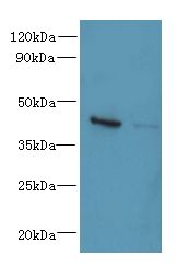 CHID1 Antibody - Western blot. All lanes: CHID1 antibody at 0.2 ug/ml. Lane 1: HeLa whole cell lysate. Lane 2: U251 whole cell lysate. Secondary antibody: Goat polyclonal to Rabbit IgG at 1:10000 dilution. Predicted band size: 45 kDa. Observed band size: 45 kDa.