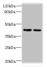 CHID1 Antibody - Western blot All lanes: CHID1 antibody at 0.2µg/ml Lane 1: Hela whole cell lysate Lane 2: U251 whole cell lysate Secondary Goat polyclonal to rabbit IgG at 1/10000 dilution Predicted band size: 45, 48, 42 kDa Observed band size: 45 kDa