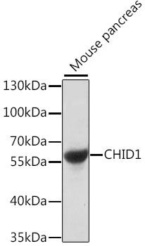 CHID1 Antibody - Western blot analysis of extracts of mouse pancreas using CHID1 Polyclonal Antibody at dilution of 1:1000.