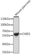 CHID1 Antibody - Western blot analysis of extracts of mouse pancreas using CHID1 Polyclonal Antibody at dilution of 1:1000.