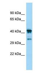 CHID1 Antibody - CHID1 antibody Western Blot of human placenta.  This image was taken for the unconjugated form of this product. Other forms have not been tested.