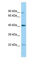 CHID1 Antibody - CHID1 antibody Western Blot of Placenta.  This image was taken for the unconjugated form of this product. Other forms have not been tested.
