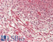 CHID1 Antibody - Human Spleen: Formalin-Fixed, Paraffin-Embedded (FFPE)