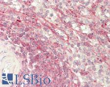 CHID1 Antibody - Human Spleen: Formalin-Fixed, Paraffin-Embedded (FFPE)