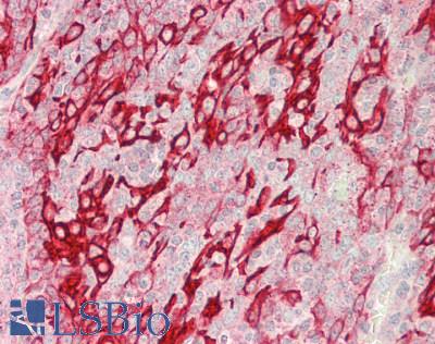 CHID1 Antibody - Human Tonsil: Formalin-Fixed, Paraffin-Embedded (FFPE)