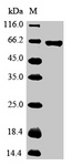 GPC3 / Glypican 3 Protein - (Tris-Glycine gel) Discontinuous SDS-PAGE (reduced) with 5% enrichment gel and 15% separation gel.