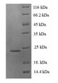Lymphotoxin-Beta / LTB Protein - (Tris-Glycine gel) Discontinuous SDS-PAGE (reduced) with 5% enrichment gel and 15% separation gel.