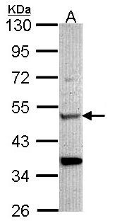 CHIT1 / Chitotriosidase Antibody - Sample (30 ug of whole cell lysate). A: Hela. 10% SDS PAGE. CHIT1 / Chitotriosidase antibody diluted at 1:1000.