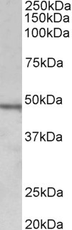 CHIT1 / Chitotriosidase Antibody - CHIT1 antibody (1 ug/ml) staining of Daudi lysate (35 ug protein in RIPA buffer). Primary incubation was 1 hour. Detected by chemiluminescence.