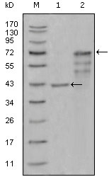 CHIT1 / Chitotriosidase Antibody - Western blot using CHIT1 mouse monoclonal antibody against truncated Trx-CHIT1 recombinant protein (1) and truncated CHIT1 (aa22-466)-hIgGFc transfected CHO-K1 cell lysate (2).