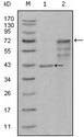 CHIT1 / Chitotriosidase Antibody - Western blot using CHIT1 mouse monoclonal antibody against truncated Trx-CHIT1 recombinant protein (1) and truncated CHIT1 (aa22-466)-hIgGFc transfected CHO-K1 cell lysate (2).