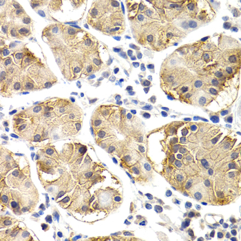 CHIT1 / Chitotriosidase Antibody - Immunohistochemistry of paraffin-embedded human normal stomach using CHIT1 antibody at dilution of 1:200 (400x lens).