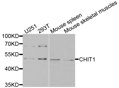 CHIT1 / Chitotriosidase Antibody - Western blot analysis of extracts of various cells.