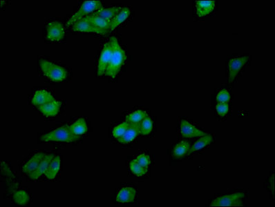 CHKA / CK / Choline Kinase Antibody - Immunofluorescence staining of HepG2 cells with CHKA Antibody at 1:100, counter-stained with DAPI. The cells were fixed in 4% formaldehyde, permeabilized using 0.2% Triton X-100 and blocked in 10% normal Goat Serum. The cells were then incubated with the antibody overnight at 4°C. The secondary antibody was Alexa Fluor 488-congugated AffiniPure Goat Anti-Rabbit IgG(H+L).