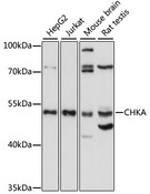 CHKA / CK / Choline Kinase Antibody - Western blot analysis of extracts of various cell lines, using CHKA antibody at 1:1000 dilution. The secondary antibody used was an HRP Goat Anti-Rabbit IgG (H+L) at 1:10000 dilution. Lysates were loaded 25ug per lane and 3% nonfat dry milk in TBST was used for blocking. An ECL Kit was used for detection and the exposure time was 30s.