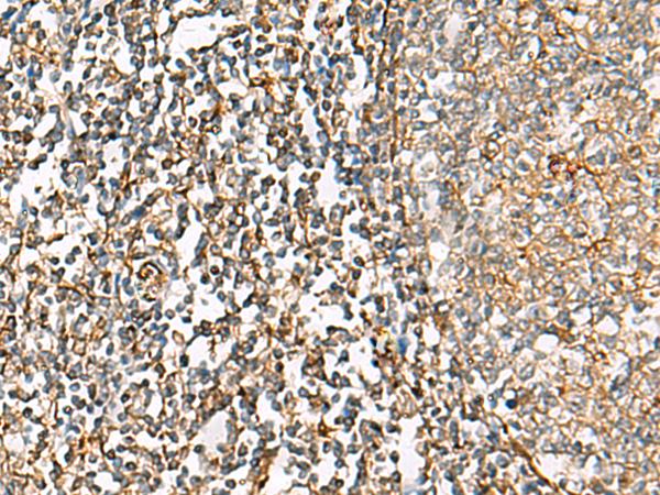 CHKA / CK / Choline Kinase Antibody - Immunohistochemistry of paraffin-embedded Human tonsil tissue  using CHKA Polyclonal Antibody at dilution of 1:35(×200)