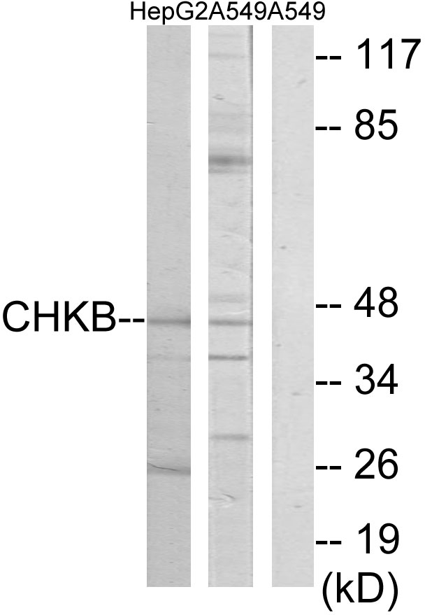 CHKB / CHKL Antibody - Western blot analysis of lysates from HepG2 and A549 cells, using CHKB Antibody. The lane on the right is blocked with the synthesized peptide.