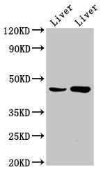 CHKB / CHKL Antibody - Positive Western Blot detected in Rat liver tissue, Mouse liver tissue. All lanes: CHKB antibody at 6.6 µg/ml Secondary Goat polyclonal to rabbit IgG at 1/50000 dilution. Predicted band size: 46, 14 KDa. Observed band size: 46 KDa