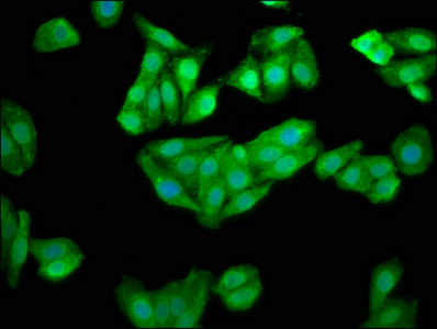 CHKB / CHKL Antibody - Immunofluorescence staining of HepG2 cells with CHKB Antibody at 1:100, counter-stained with DAPI. The cells were fixed in 4% formaldehyde, permeabilized using 0.2% Triton X-100 and blocked in 10% normal Goat Serum. The cells were then incubated with the antibody overnight at 4°C. The secondary antibody was Alexa Fluor 488-congugated AffiniPure Goat Anti-Rabbit IgG(H+L).