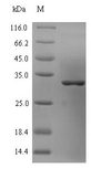 omcB Protein - (Tris-Glycine gel) Discontinuous SDS-PAGE (reduced) with 5% enrichment gel and 15% separation gel.