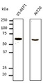 CHM / REP1 Antibody - Western blot. Anti-REP1 antibody at 1:1000 dilution. HEK293 cells transfected with V5-REP1 and AtT20 cells. Lysates at 100 ug per lane. Rabbit polyclonal to goat IgG (HRP) at 1:10000 dilution.