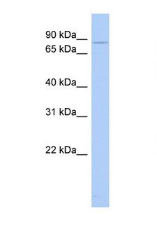 CHM / REP1 Antibody - CHM antibody Western blot of Fetal Thymus lysate. Antibody concentration 1 ug/ml. This image was taken for the unconjugated form of this product. Other forms have not been tested.