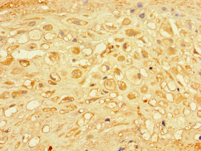 CHM / REP1 Antibody - Immunohistochemistry of paraffin-embedded human placenta tissue using CHM Antibody at dilution of 1:100