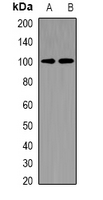 CHM / REP1 Antibody - Western blot analysis of REP-1 expression in H460 (A); HeLa (B) whole cell lysates.